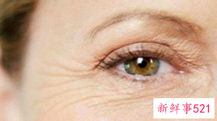 一分钟彻底搞定鱼尾纹的秘密