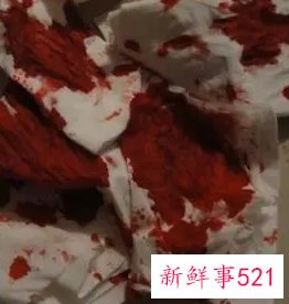 梦见下面流好多血什么预兆