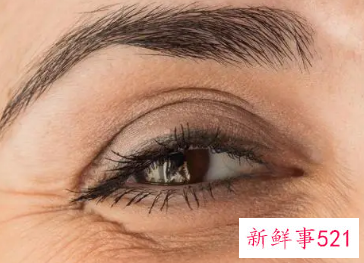 怎样消除眼部周围的皱纹