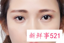 半永久纹眉2年后能彻底掉吗