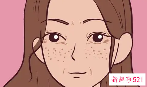 选择好属于自己的祛斑方法