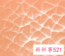 肌肤纹理是什么
