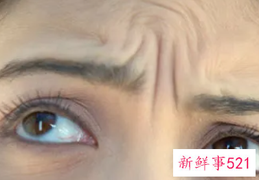 什么去皱纹最好