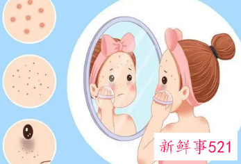 暗沉斑怎么祛除