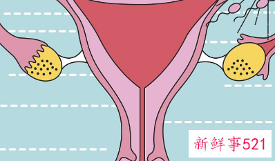 保胎期间一直有褐色分泌物怎么办右腹疼痛