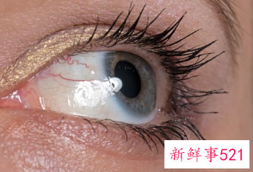 眼睛干涩疼痛是什么原因