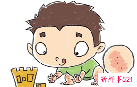 皮肤晒伤色素沉着太久可以恢复吗