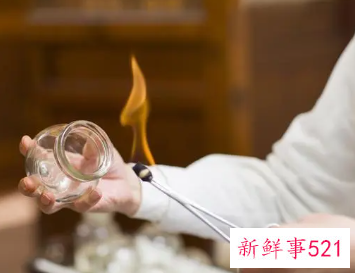 女人拔罐有好处吗
