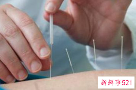 埋线减肥的风险有哪些