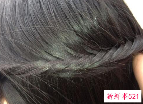 分享几个实用的去头屑小妙招