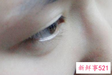 女性脸部衰老的表现