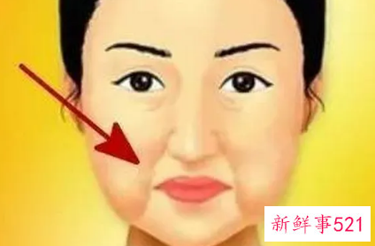 脸部下垂还有救吗