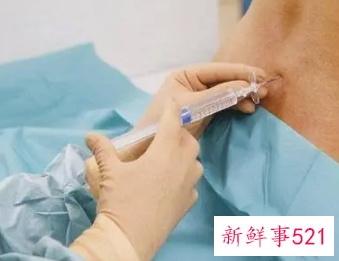 剖腹产对身体的伤害