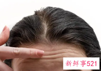 额头皱纹多怎么消除