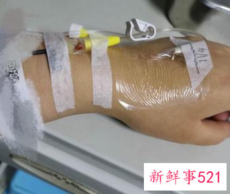 女人梦见住院打针