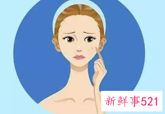 祛斑后要注意什么