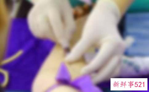 发梢干枯分叉怎么护理