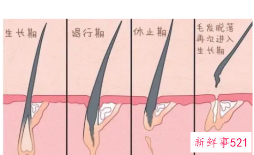 毛囊死了还能不能生发