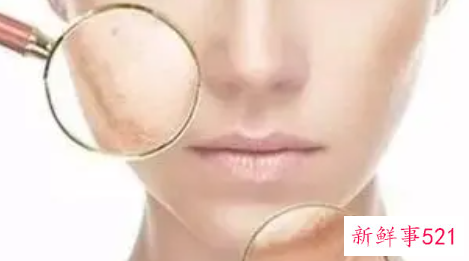 有什么办法改善脸部的皮肤