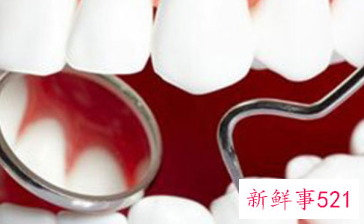 如何清理吸烟黄牙