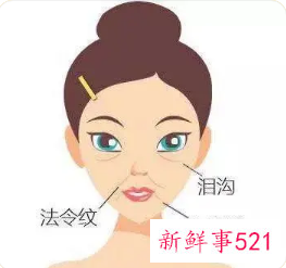 泪沟一旦形成很难消掉吗