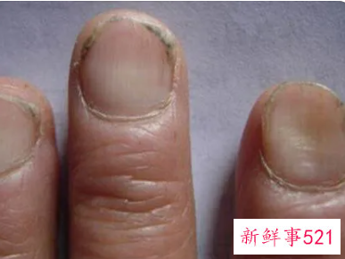 怎样保持指甲缝里不脏