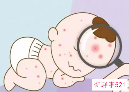 体外过敏原检测结果是什么