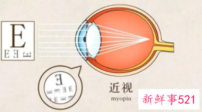 近视眼怎么慢慢恢复视力600度