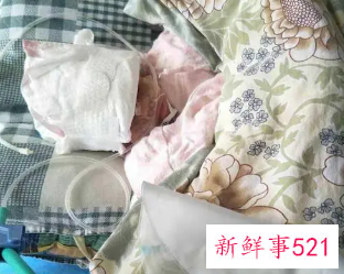 五个月早产活下来了