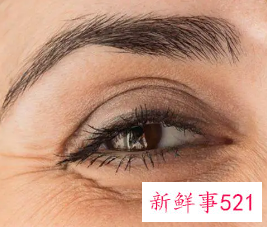 皱纹和笑纹的区别