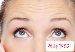 什么去皱纹最好