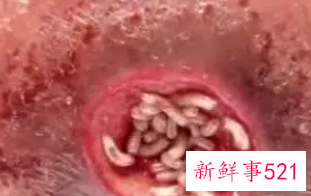 梦见身上挤出蛆虫