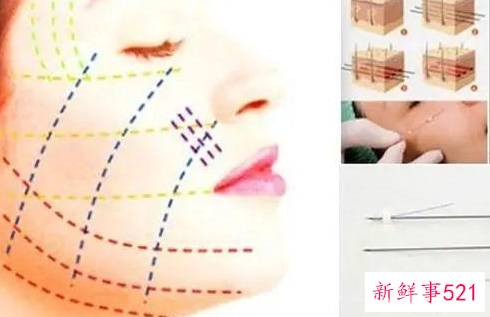 我们为什么要做皮肤抗衰