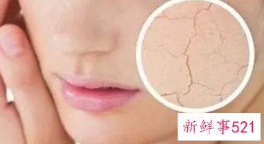 有什么办法改善脸部的皮肤