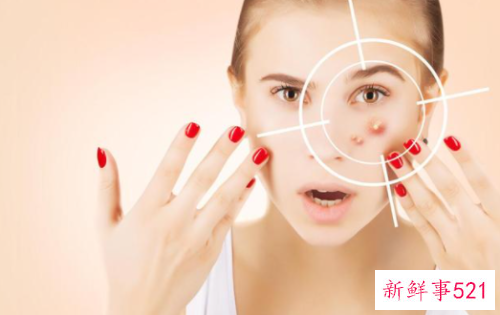 冬季容易出现三大肌肤问题