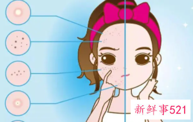 去角质能把斑去掉吗