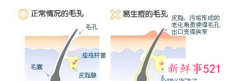 男士油皮护肤品推荐