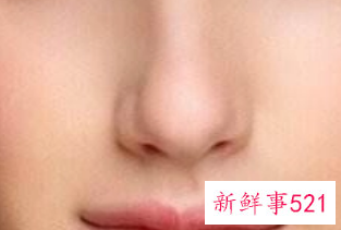 怎样让鼻子变挺