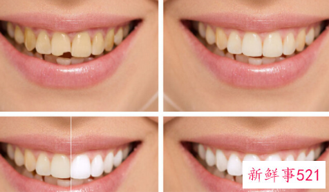 如何清理吸烟黄牙