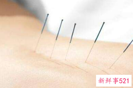 埋线减肥的风险有哪些