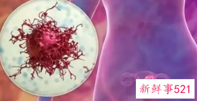 女性尿道口痒能自愈吗