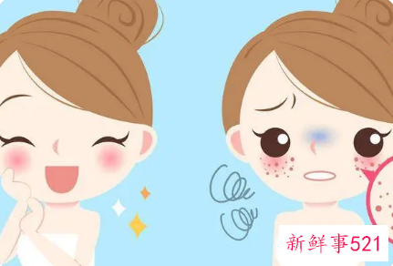 在家最简单淡斑方法