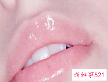 嘴上起泡怎么快速处理