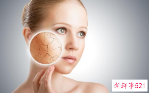 冬季容易出现三大肌肤问题