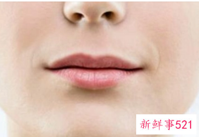 脸部下垂还有救吗