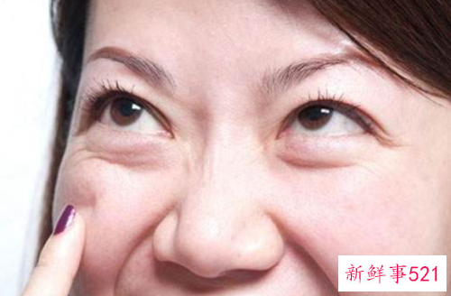 用什么去眼袋最快最有效