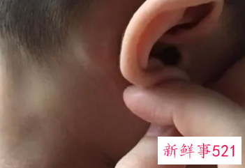 小孩耳朵里面疼什么原因