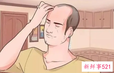 如何治理脱发呢
