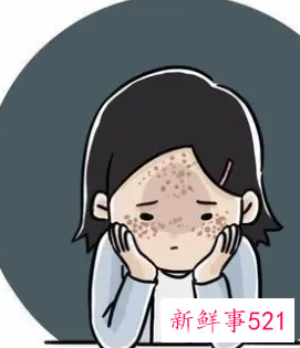 有一种祛斑的药膏叫什么名字