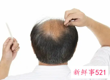 梦见秃头的男子寓意